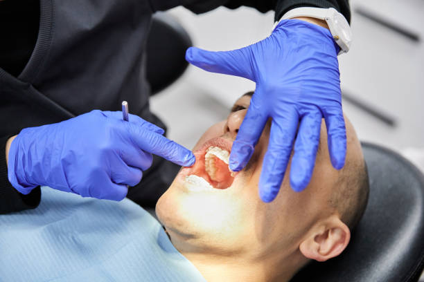 Best Tooth Infection Emergency Dentist  in Newark, CA